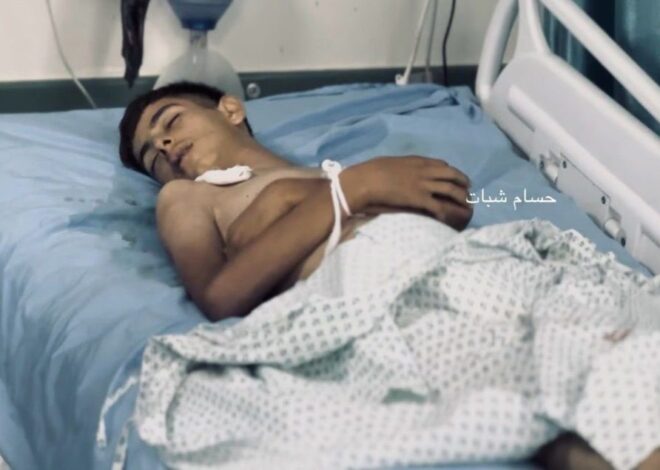 As Israelis Blockade Food to Gaza, 9,000 Children have been Admitted for Acute Malnutrition