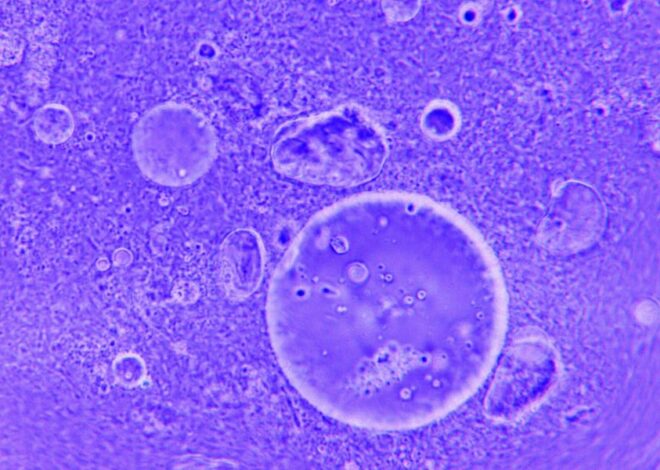 Concerns Regarding Nanoparticles as Pathogens and the Future of Nanodiagnostics