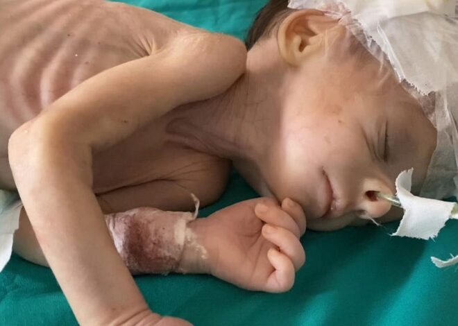 We’re all pretending to be mad at Israel now that 14,000 babies are starving to death