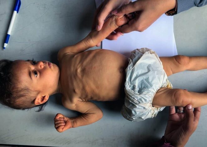 Israel isn’t starving healthy children to death. Just the ones with preexisting conditions. – Mondoweiss