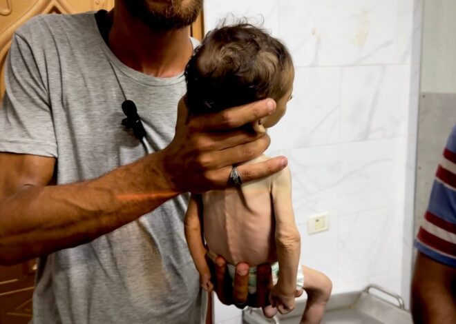 When the bodies of starving children in Gaza reach a ‘point of no return’ – Mondoweiss