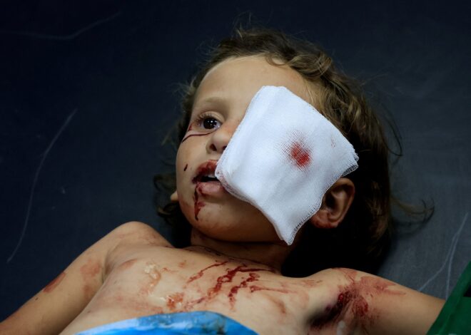 Israeli Forces Kill 93 Palestinians in Gaza Over 24 Hours
