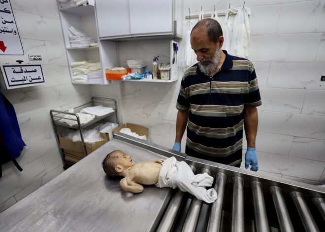 Fifteen More Palestinians Starve To Death in Gaza Due to US-Backed Israeli Blockade