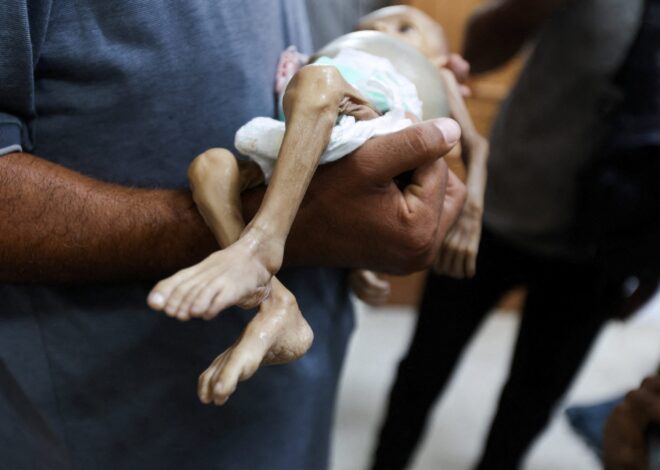 Twenty More Palestinians Starve to Death in Gaza in Three Days Due to Israeli Blockade