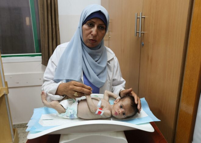 Seven More Palestinians Starve to Death in Gaza Due to Israeli Siege