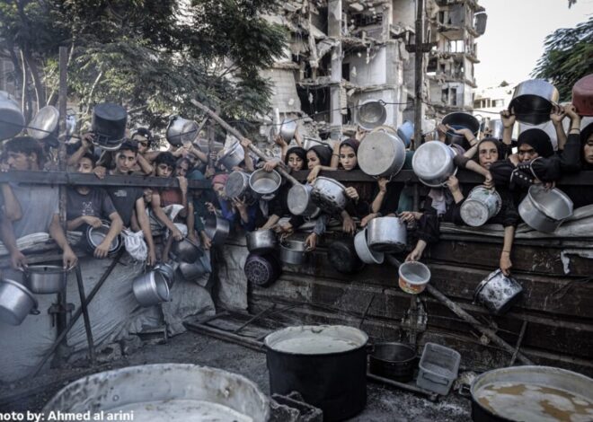 Impending wave of organ failure deaths – War on Gaza Day 651