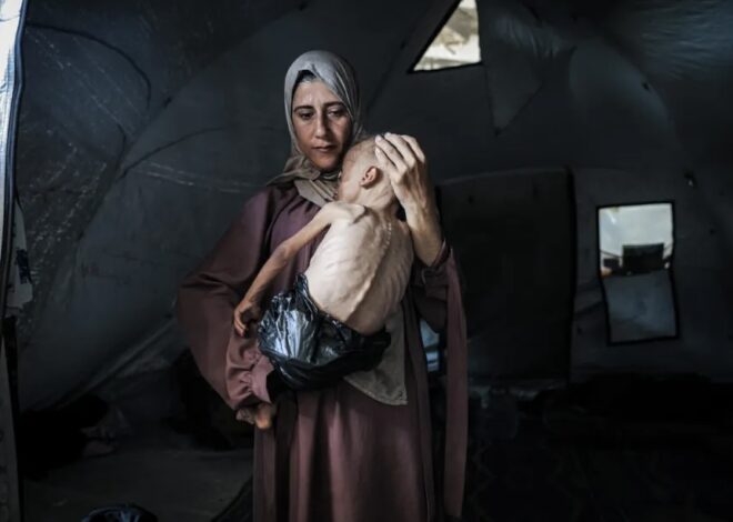 101 Gazans die of starvation, incl 89 kids – War on Gaza Day 655