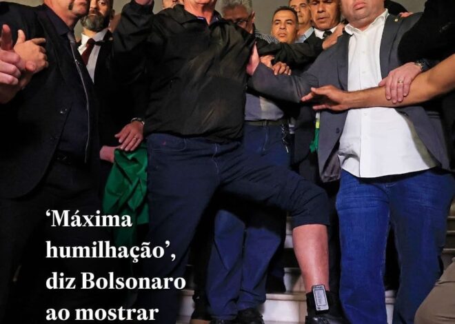 Bolsonaro With His Electronic Ankle Device