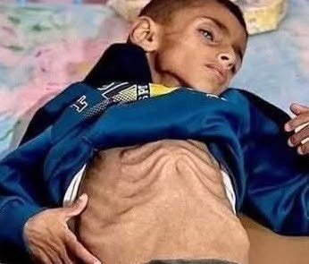 Israel’s Latest Strategies of Deliberate Starvation