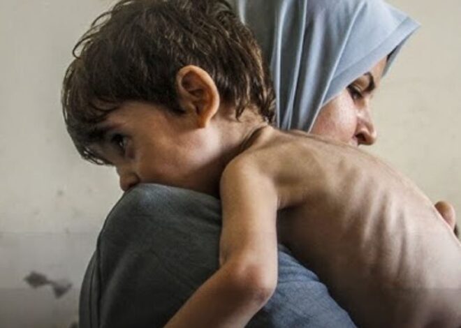 Time to Admit It—This Is a Global Genocide Against the Palestinians