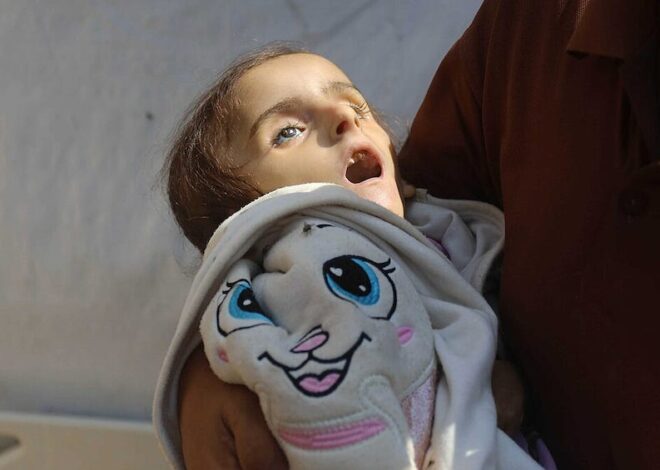 Gaza Isn’t Starving, It Is Being Starved
