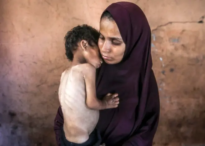 How Israel is Starving Gaza