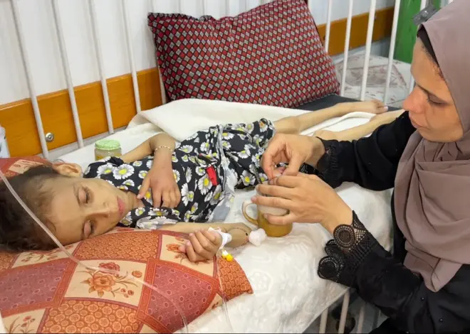 Forcing Parents in Gaza to Watch Their Children Die of Hunger