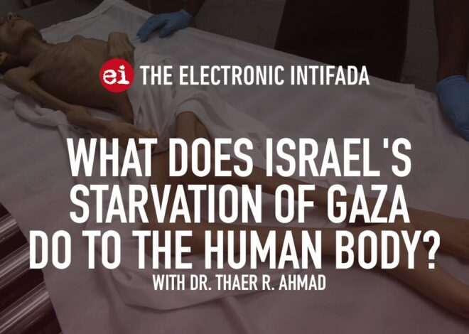 What does Israelâs starvation of Gaza do to the human body? With Dr. Thaer Ahmad