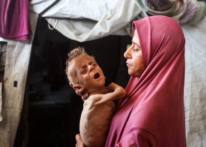 Israeli Doctors Say Gaza Children Are Starving Due to Israel’s Blockade, Not Because of Pre-Existing Medical Conditions