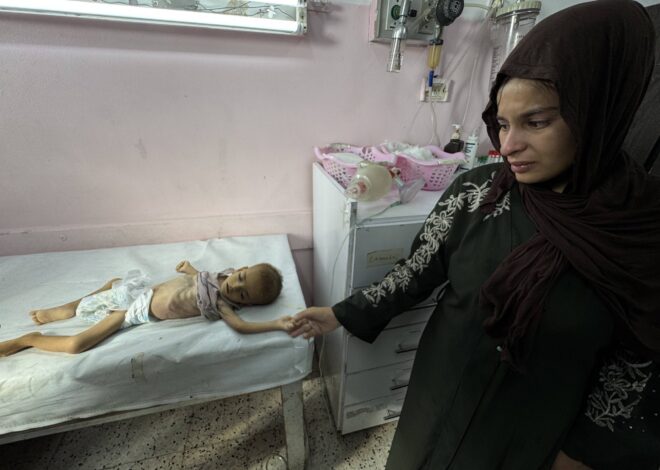 Four More Palestinians Starve to Death in Gaza Due to Israeli Blockade