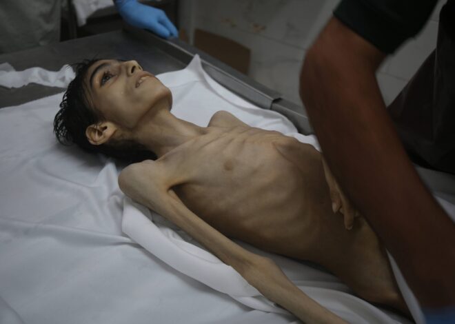 Nineteen Palestinians Starve to Death in Gaza Over Three Days Due to Israeli Blockade