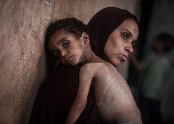 Gaza’s children are the most vulnerable victims of starvation