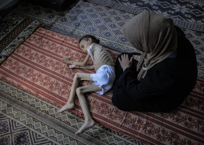 Israeli impunity brings starvation, death – War on Gaza Day 666