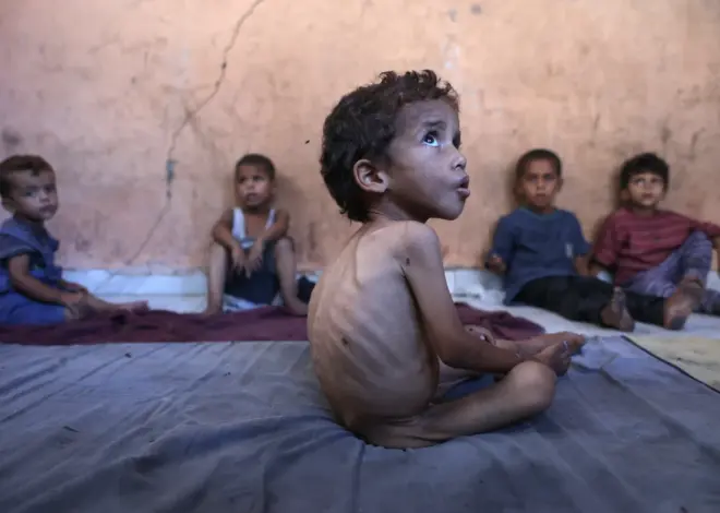 Mainstream media sidelined Gaza hunger reports, until it couldn’t