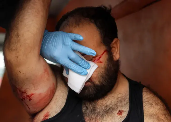 Israel blinds thousands in Gaza