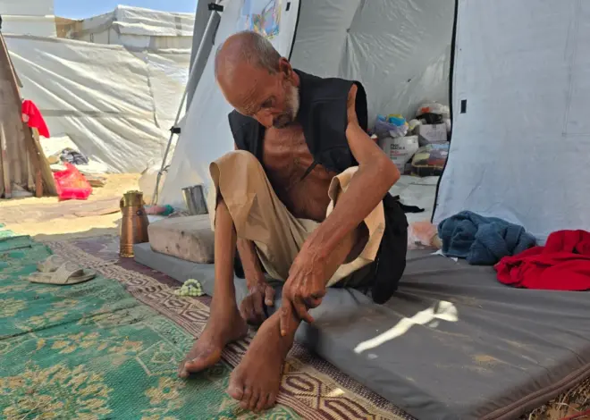 Gaza’s pregnant and elderly bear brunt of Israel’s starvation