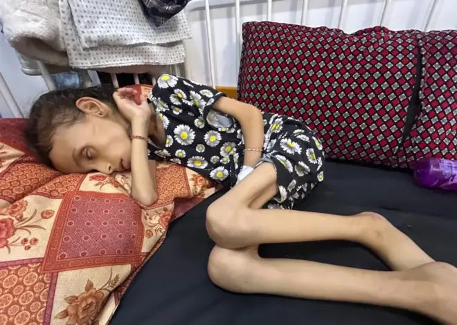 The hunger we face in Gaza is Israel’s weapon of war