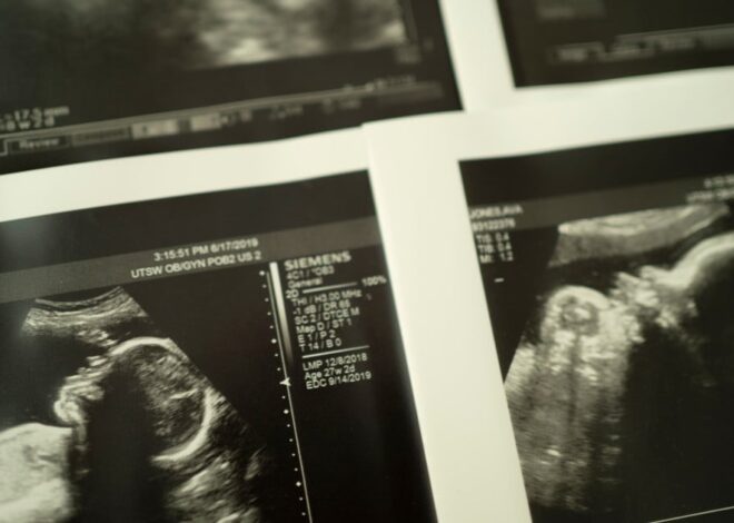 NIH Launches New Multimillion-Dollar Stillbirth Prevention Effort — ProPublica