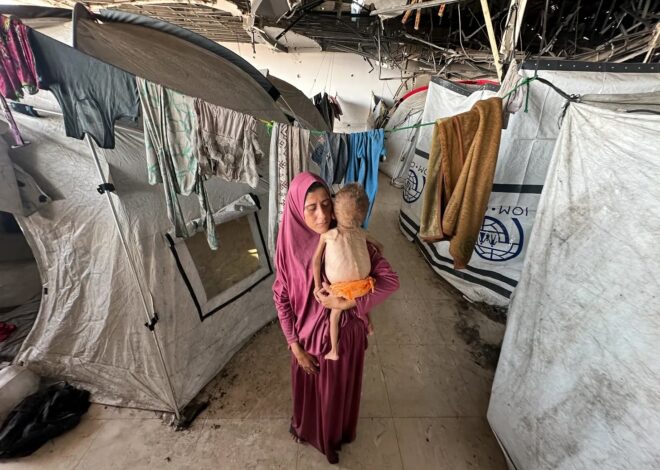 The Complete Story on Gaza’s Starving Children the Free Press Hid