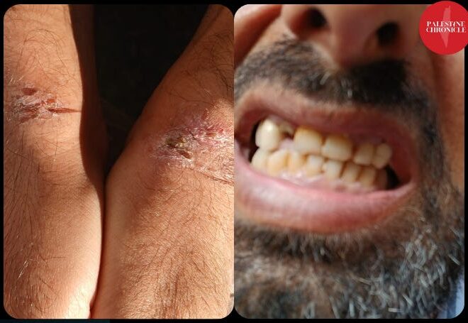 Freed Prisoner Speaks to the Palestine Chronicle