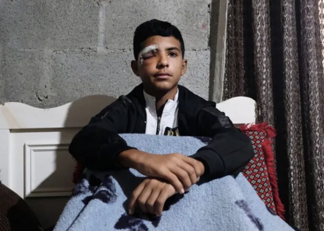 At the Bus Stop, an Israeli Soldier Shot Him in the Face