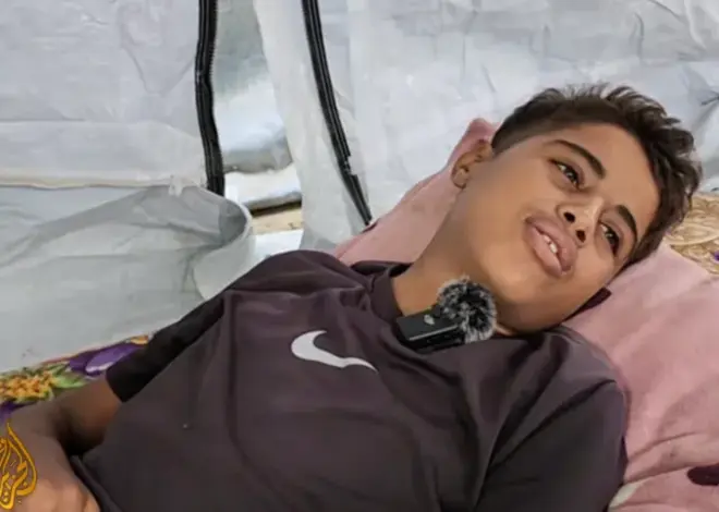 The ever-present wounds of Gaza’s children from Israel’s war