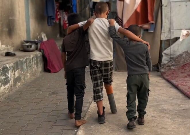 Israel Forces Child Amputees in Gaza to Use Makeshift Prosthetics