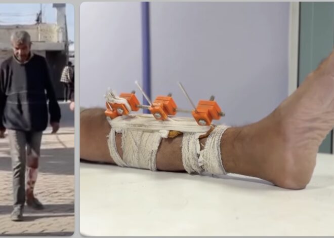 Palestinian ingenuity shines thru adversity: Not Ceasefire Day 70