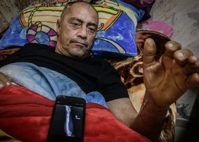 After an Israeli Settler Attack, a Palestinian’s Life is Upended