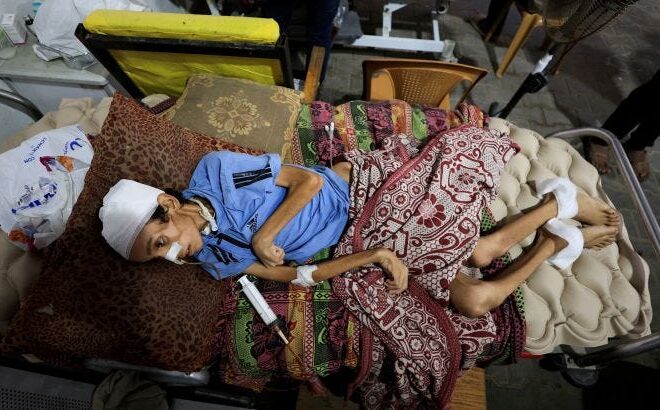 Hiding the true numbers it has killed in Gaza