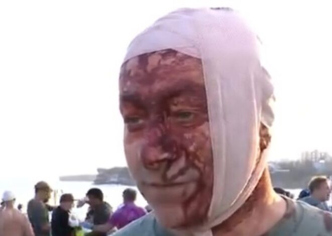 Here is everything the media is not telling you about the Bondi beach shooting