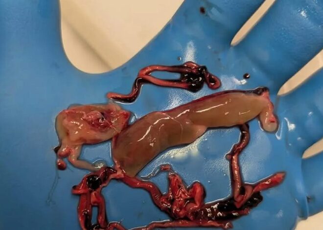 Tom Haviland Speaks Out Against mRNA