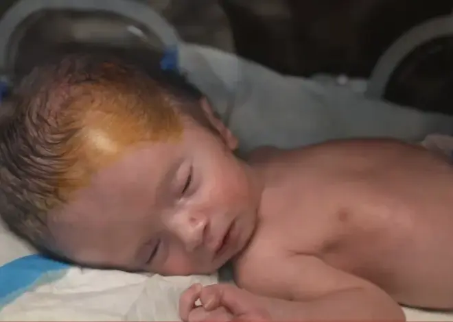 Gaza’s unseen casualties: A surge in stillbirths & birth defects