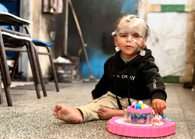 Born during genocide: Gaza’s child survivors bear the scars