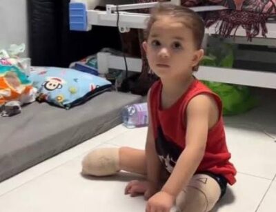 Hundreds of Gaza amputees are stranded in legal limbo