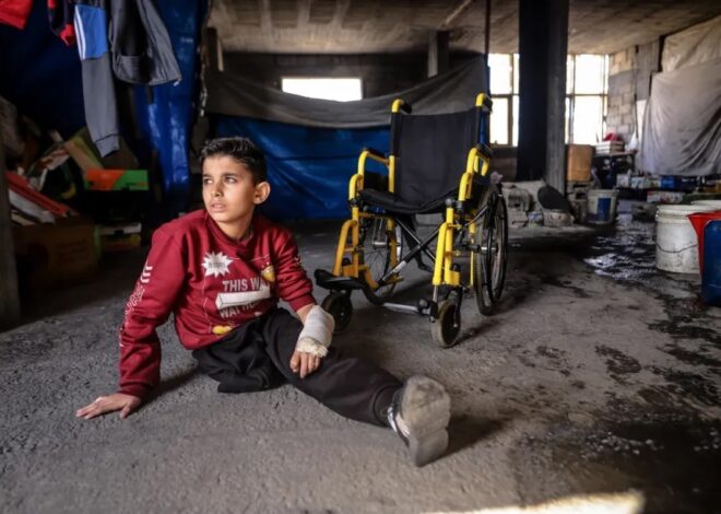 6K Gazans lack prosthetic &/or rehabilitation care – Daily Update