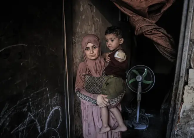 43,000 people in Gaza suffered life-changing injuries in 3 years