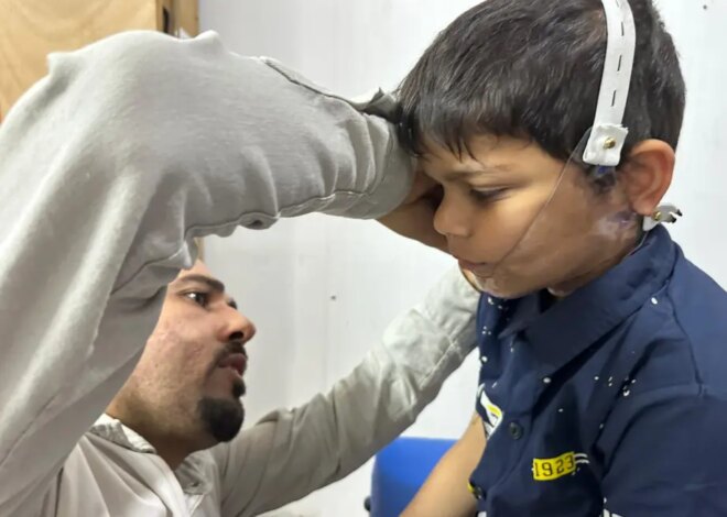 Médecins Sans Frontières step up efforts to address facial injuries in Gaza – Middle East Monitor