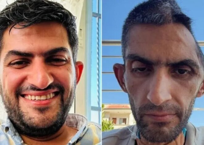 ‘Shocking’ photo of freed Palestinian journalist shows ‘tragic’ conditions in Israeli prisons: Rights group – Middle East Monitor