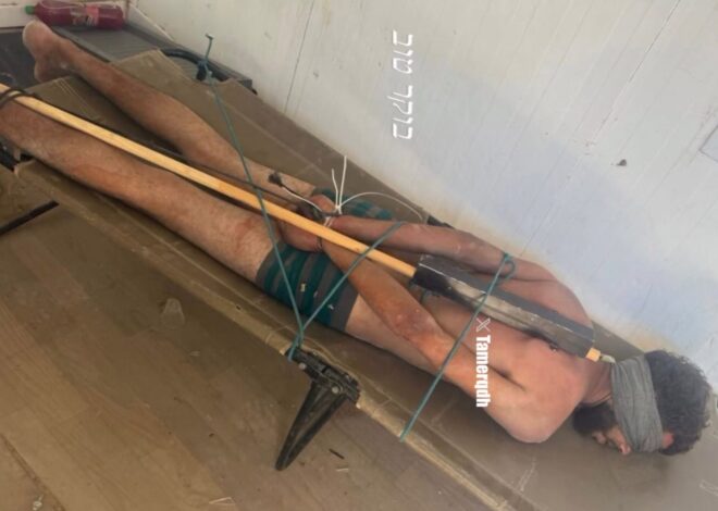 More evidence of Israeli torture of prisoners – Daily Update