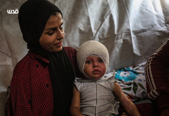 Israel’s “ceasefire” in Gaza includes shooting children in the head – Daily Update