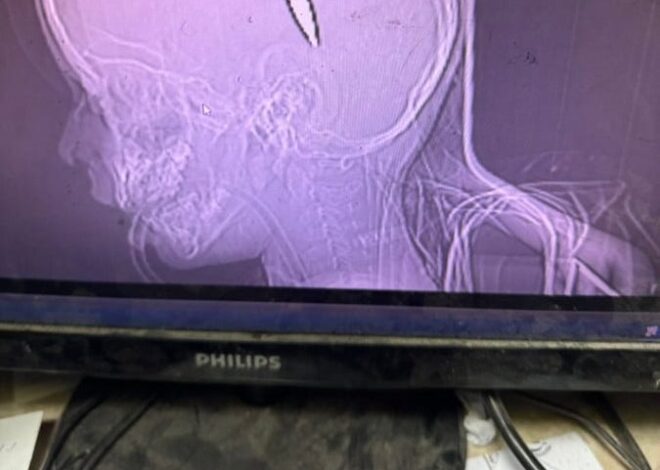 When Palestinian injuries are dubbed “fake”