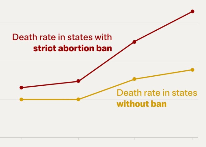 Ectopic Pregnancy Deaths Have Nearly Doubled. It’s Worse in Abortion-Ban States. — ProPublica