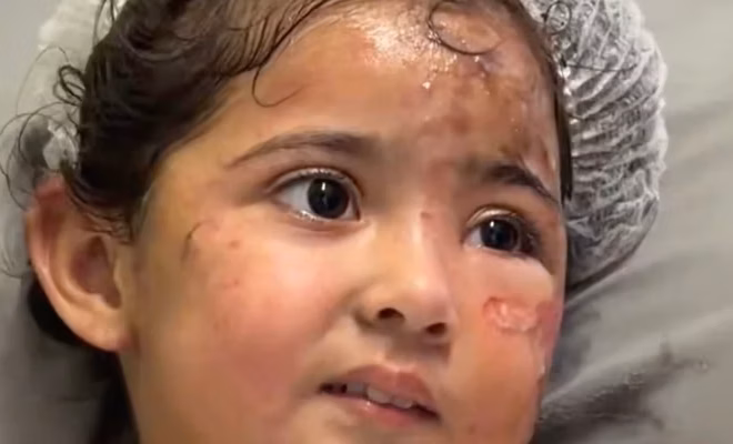 Gaza Mother Burned Alive in Front of Toddler, Nobody Covered it
